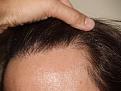 Click image for larger version

Name:	16 Months Close-Up 2.jpg
Views:	368
Size:	94.4 KB
ID:	452938