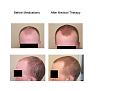 Click image for larger version

Name:	Slide2.JPG
Views:	585
Size:	37.1 KB
ID:	453019