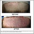 Click image for larger version

Name:	Fig4--Burns 2010--700x700--B--Before After.jpg
Views:	678
Size:	96.2 KB
ID:	453039
