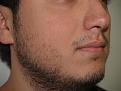 Click image for larger version

Name:	Before Beard.jpg
Views:	10734
Size:	98.1 KB
ID:	453133