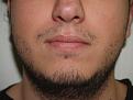 Click image for larger version

Name:	Before Beard Front.jpg
Views:	6393
Size:	98.4 KB
ID:	453134