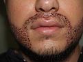Click image for larger version

Name:	Immediately After Beard 2.jpg
Views:	10745
Size:	94.1 KB
ID:	453136