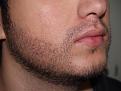 Click image for larger version

Name:	After Beard2.jpg
Views:	3716
Size:	96.4 KB
ID:	453139