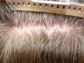 Click image for larger version

Name:	AFTERSCAR2.jpg
Views:	307
Size:	93.6 KB
ID:	453201