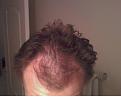 Click image for larger version

Name:	hair1.jpg
Views:	4340
Size:	45.4 KB
ID:	453213