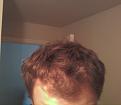 Click image for larger version

Name:	hair2.jpg
Views:	1849
Size:	47.4 KB
ID:	453214