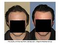 Click image for larger version

Name:	Slide1.JPG
Views:	568
Size:	57.7 KB
ID:	453291