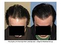 Click image for larger version

Name:	Slide2.JPG
Views:	547
Size:	65.0 KB
ID:	453292