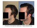Click image for larger version

Name:	Slide3.JPG
Views:	542
Size:	63.9 KB
ID:	453293