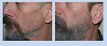 Click image for larger version

Name:	before and after1.jpg
Views:	984
Size:	37.4 KB
ID:	453342