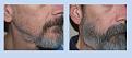 Click image for larger version

Name:	before and after2.jpg
Views:	1673
Size:	36.9 KB
ID:	453343