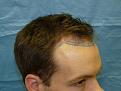 Click image for larger version

Name:	pre-op 06.jpg
Views:	276
Size:	47.9 KB
ID:	453426