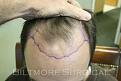 Click image for larger version

Name:	BE a preop.jpg
Views:	394
Size:	18.2 KB
ID:	453898