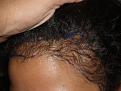Click image for larger version

Name:	Before Hairline Marked.jpg
Views:	355
Size:	85.0 KB
ID:	453957