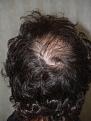 Click image for larger version

Name:	Before Crown.jpg
Views:	468
Size:	95.8 KB
ID:	453966