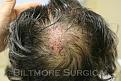 Click image for larger version

Name:	FJ f immpo.jpg
Views:	606
Size:	29.8 KB
ID:	454070