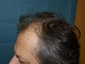 Click image for larger version

Name:	pre-op 03.jpg
Views:	383
Size:	54.5 KB
ID:	454244