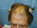 Click image for larger version

Name:	pre-op 06.jpg
Views:	373
Size:	56.0 KB
ID:	454247