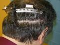 Click image for larger version

Name:	9 months post-op 011.jpg
Views:	357
Size:	78.9 KB
ID:	454262