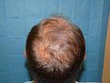 Click image for larger version

Name:	pre-op 04.jpg
Views:	461
Size:	49.8 KB
ID:	454314