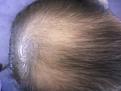 Click image for larger version

Name:	hair.jpg
Views:	771
Size:	49.5 KB
ID:	454414