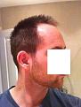 Click image for larger version

Name:	hairline1x.jpg
Views:	967
Size:	35.3 KB
ID:	454462