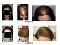 Click image for larger version

Name:	AUG2011.jpg
Views:	370
Size:	58.7 KB
ID:	454584