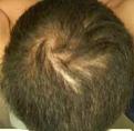Click image for larger version

Name:	Bald1.jpg
Views:	575
Size:	9.7 KB
ID:	454585