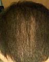 Click image for larger version

Name:	bald2.jpg
Views:	556
Size:	8.7 KB
ID:	454586