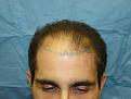 Click image for larger version

Name:	pre-op 05.jpg
Views:	313
Size:	48.1 KB
ID:	454620