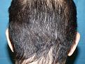 Click image for larger version

Name:	9 months post-op 10.jpg
Views:	296
Size:	99.1 KB
ID:	454634