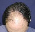 Click image for larger version

Name:	Before.jpg
Views:	275
Size:	91.2 KB
ID:	454689