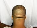Click image for larger version

Name:	Post Op 082.jpg
Views:	466
Size:	85.5 KB
ID:	454750