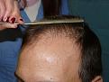 Click image for larger version

Name:	pre-op 03.jpg
Views:	336
Size:	48.0 KB
ID:	454823
