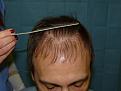 Click image for larger version

Name:	pre-op 05.jpg
Views:	327
Size:	39.4 KB
ID:	454825