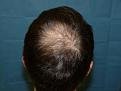 Click image for larger version

Name:	pre-op 09.jpg
Views:	316
Size:	31.3 KB
ID:	454829