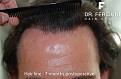 Click image for larger version

Name:	5.jpg
Views:	601
Size:	67.0 KB
ID:	454916