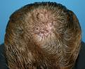 Click image for larger version

Name:	Post-op.jpg
Views:	356
Size:	93.2 KB
ID:	454965