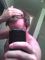 Click image for larger version

Name:	bald2.jpg
Views:	413
Size:	43.5 KB
ID:	454978