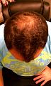 Click image for larger version

Name:	AfterHair1.jpg
Views:	2283
Size:	95.9 KB
ID:	455031