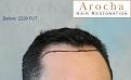 Click image for larger version

Name:	3_Before.jpg
Views:	474
Size:	30.0 KB
ID:	455096
