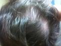 Click image for larger version

Name:	HAIR BACK.jpg
Views:	720
Size:	36.3 KB
ID:	455106