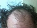 Click image for larger version

Name:	HAIR FRONT.jpg
Views:	742
Size:	72.5 KB
ID:	455107