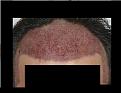 Click image for larger version

Name:	Front looking down.JPG
Views:	1477
Size:	49.3 KB
ID:	455480