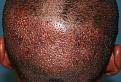 Click image for larger version

Name:	Immed. Post-op-3.jpg
Views:	306
Size:	98.4 KB
ID:	455506
