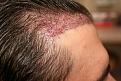 Click image for larger version

Name:	Immed Post op 2.jpg
Views:	370
Size:	95.8 KB
ID:	455555