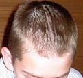 Click image for larger version

Name:	12 years old Top.JPG
Views:	729
Size:	15.5 KB
ID:	455609