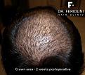 Click image for larger version

Name:	11.jpg
Views:	567
Size:	44.9 KB
ID:	455667