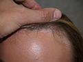 Click image for larger version

Name:	Hairline Close.jpg
Views:	526
Size:	99.7 KB
ID:	456045