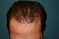 Click image for larger version

Name:	Immed. Post-Op-1.jpg
Views:	445
Size:	90.8 KB
ID:	456058